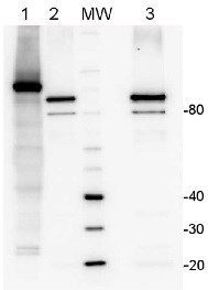 LOX | Lipoxygenase (Affinity purified) in the group Antibodies Plant/Algal / Developmental Biology / Lipid metabolism at Agrisera AB (Antibodies for research) (AS06 128A)